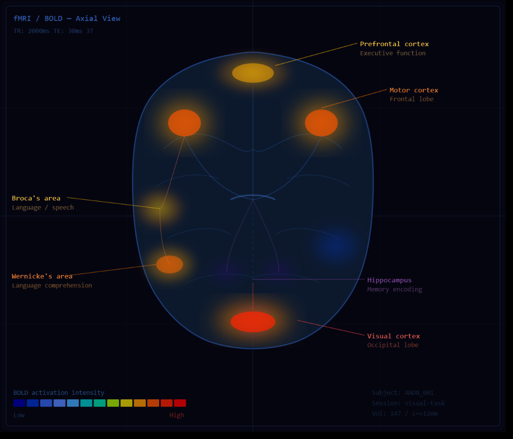 fMRI BOLD Activation Diagram